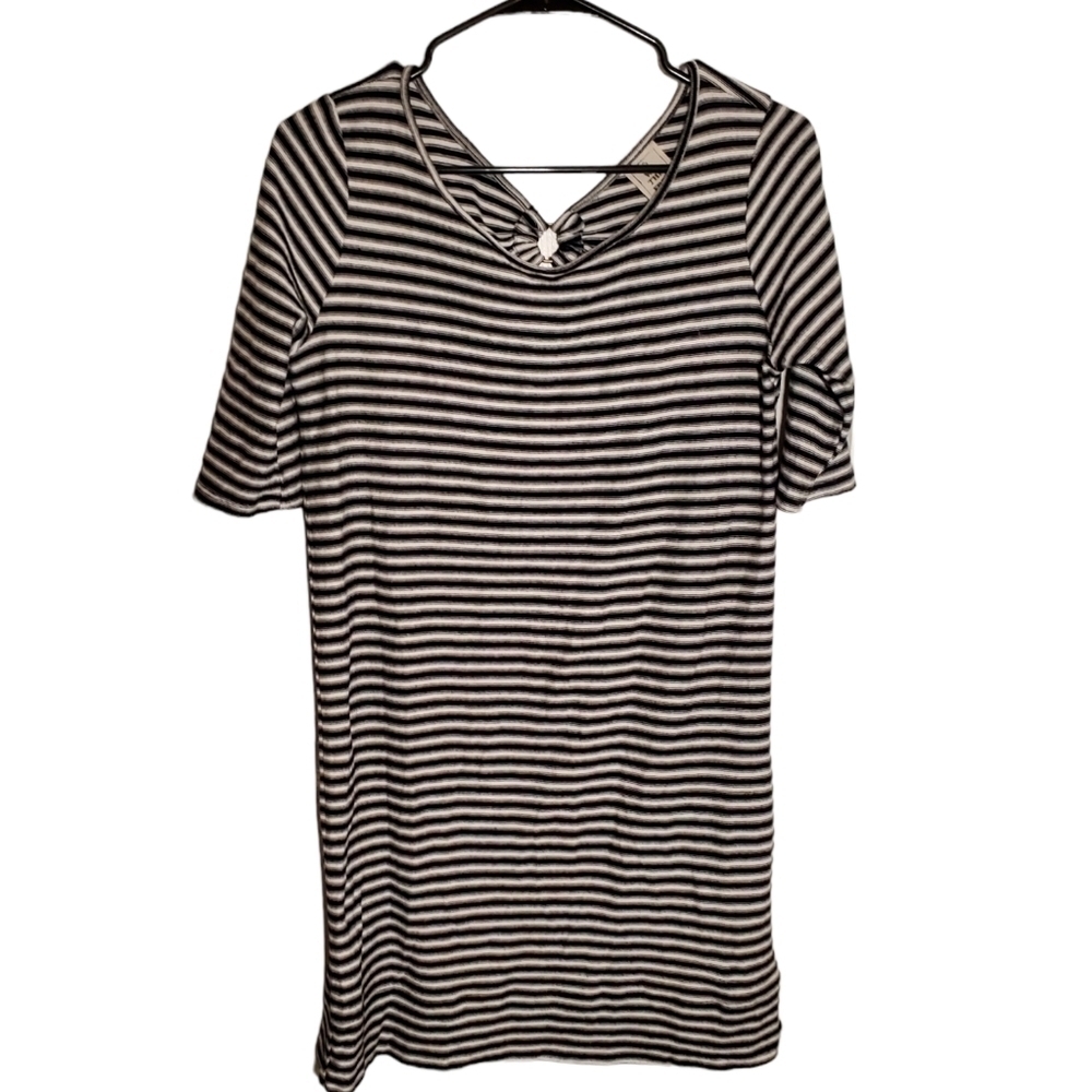 𝅺WE the Free Striped Dress with Open Back Detail